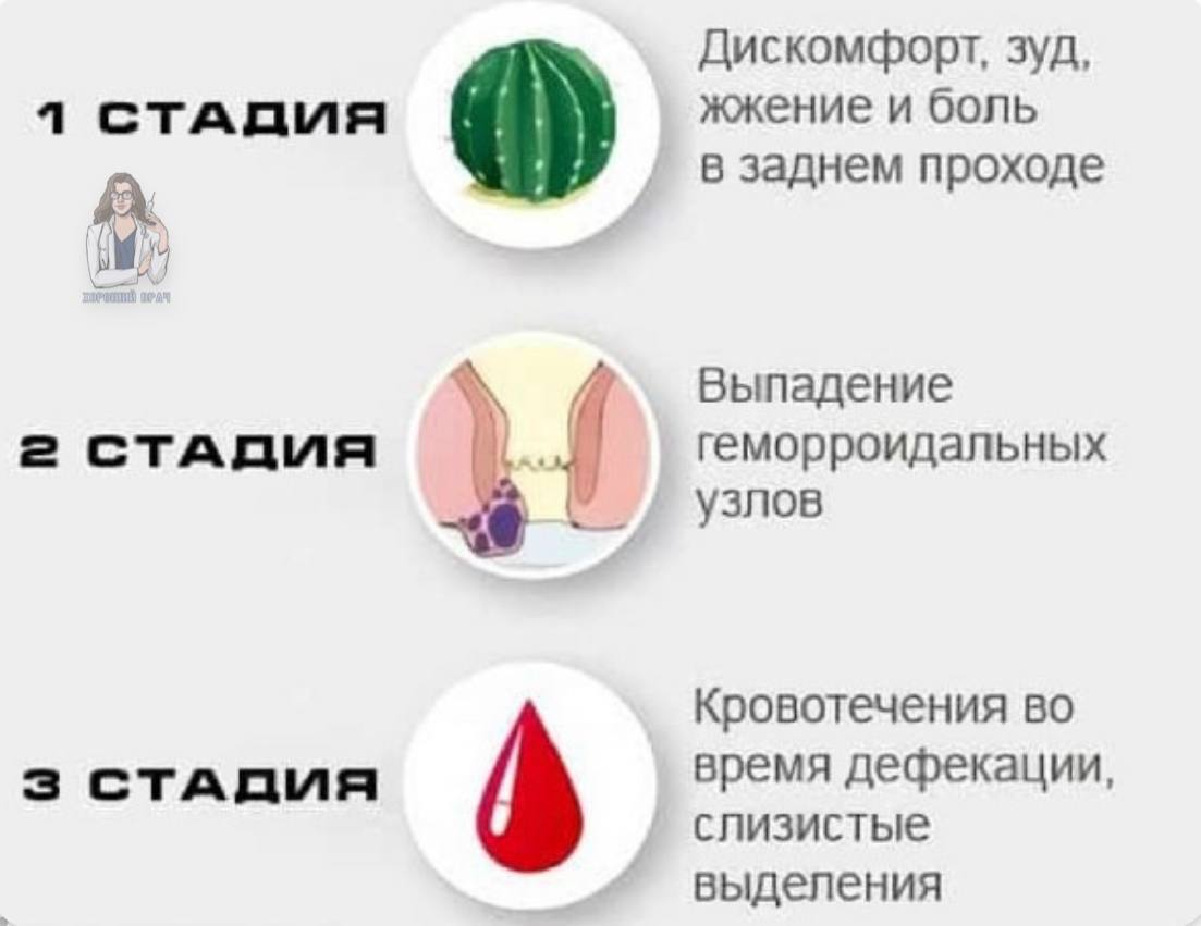 У девушки задница зачесалась и она захотела анальный секс.